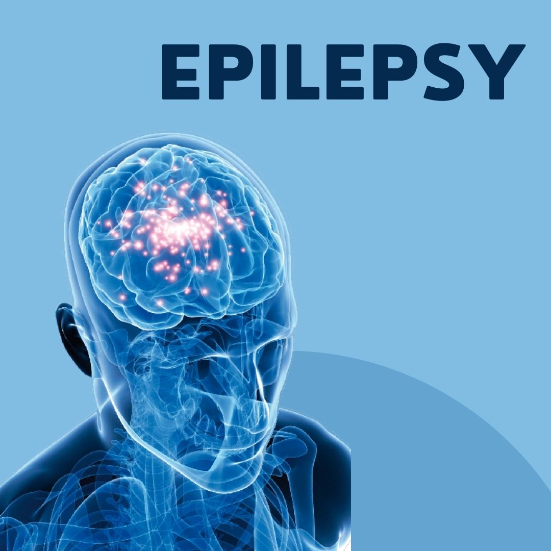 Epilepsy