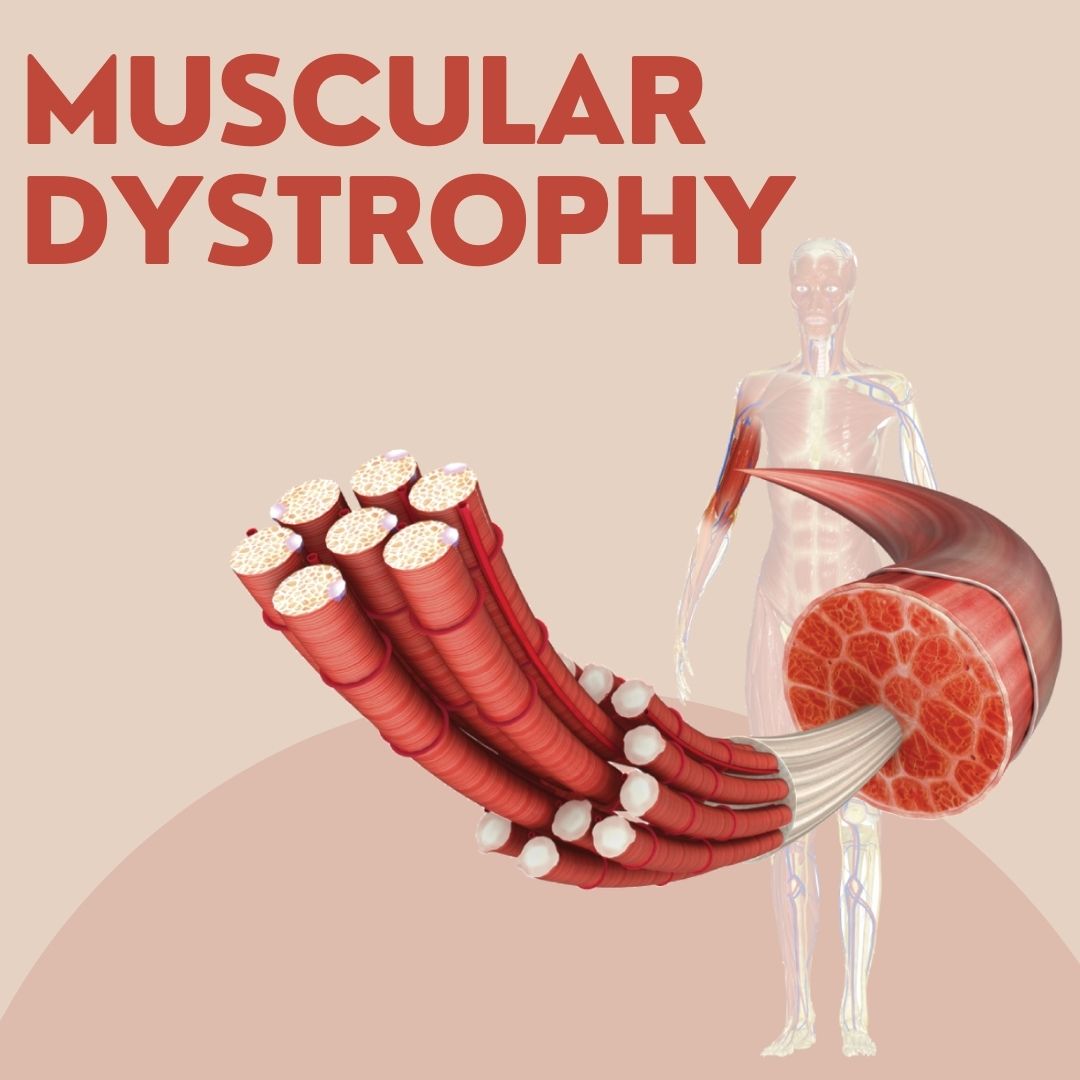 Muscular Dystrophy