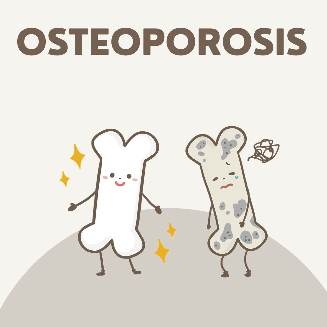 Osteoporosis