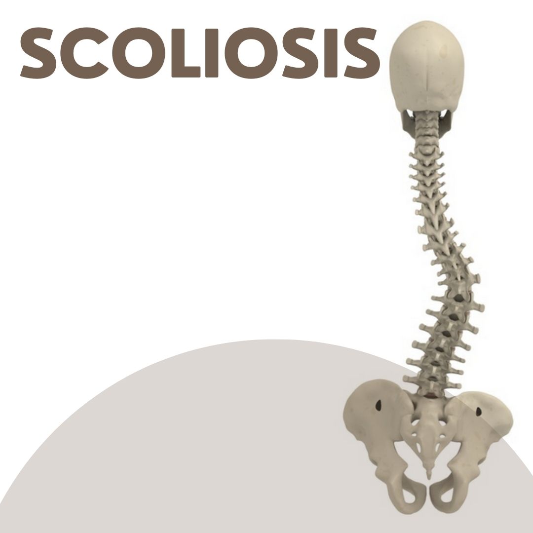 Scoliosis